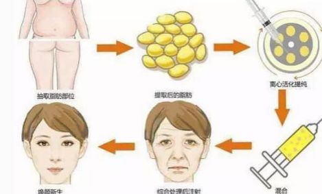 沈陽整形醫(yī)院排行榜！看看哪個(gè)科室比較靠譜，信譽(yù)超棒~