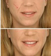 武漢黑痣手術(shù)醫(yī)院排行榜：十家必看良心機(jī)構(gòu)