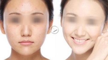 蘇州瘦腹整形醫(yī)院口碑榜單大揭秘