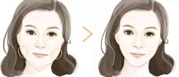 安陽光纖溶脂美容醫(yī)院哪家好？實力機構揭秘