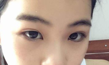 上海哪家整形醫(yī)院有優(yōu)秀的激光除皺技術(shù)？