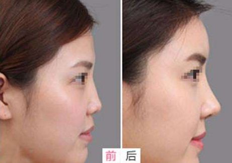 武漢整形醫(yī)院排行榜公布！拉皮手術(shù)專家競(jìng)逐首席，華美、美萊力爭(zhēng)前五！