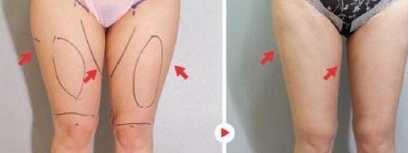 上海木偶紋手術(shù)醫(yī)院口碑排名：實(shí)力見(jiàn)證，打造緊致容顏