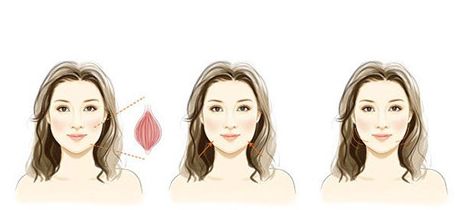 腰腹抽脂十年真實(shí)體驗(yàn)分享：痛感、恢復(fù)及常見后遺癥