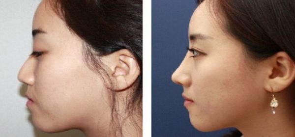 蘇州彩光美容整形醫(yī)院排名前10的技術(shù)優(yōu)勢解析