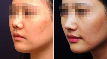 哈爾濱激光除皺和抗衰老整形醫(yī)院排行榜