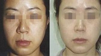 2023年北京治療近視好的醫(yī)院排行榜，優(yōu)質(zhì)醫(yī)院推薦