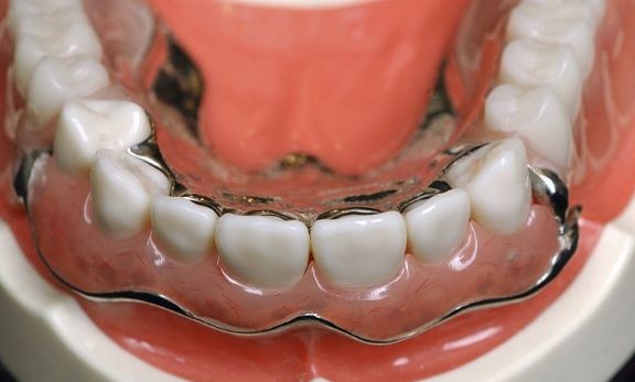 龍崗中心醫(yī)院雙眼皮手術(shù)費(fèi)用詳情，成功案例分享，熱門醫(yī)生預(yù)約攻略！