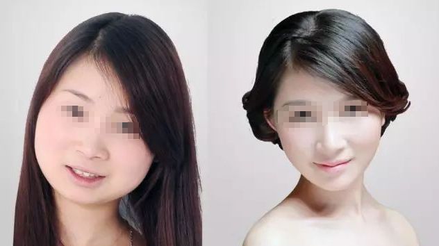 寧波十大資深眼袋手術(shù)醫(yī)院口碑精選