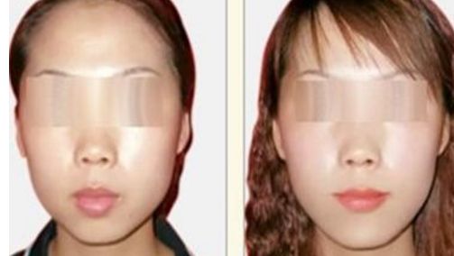 昆明紅血絲治療醫(yī)院排名TOP10揭秘！