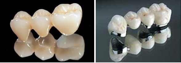 廈門微針痘坑治療推薦前十醫(yī)院，免費咨詢！