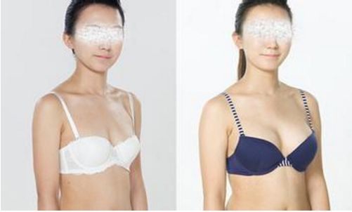 選擇福州水光針去痘美容醫(yī)院排行榜前十強的技巧