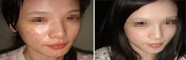 蘇州激光點陣去眼紋排名前十美容醫(yī)院指南