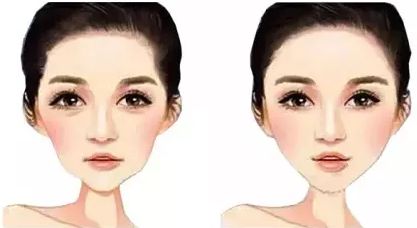 北京八大處雙眼皮掛什么科，怎樣專業(yè)修復(fù)雙眼皮問(wèn)題？相關(guān)專家分享及病例反饋