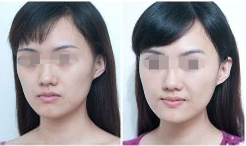 樂山眼周紋祛除醫(yī)院排名TOP10，口碑實錄揭秘！