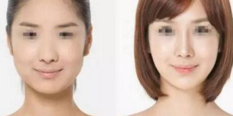 南昌去口周紋整形醫(yī)院口碑榜單：專業(yè)咨詢，放心選擇