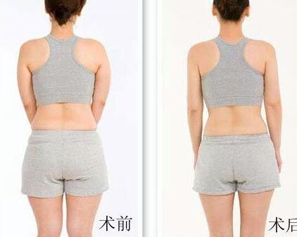 最新出爐！10大太原祛抬頭紋整形機(jī)構(gòu)推薦指南