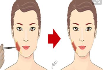 洛陽(yáng)祛眼角細(xì)紋十大口碑醫(yī)院排名公布！