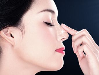 深圳哪些醫(yī)院在脂肪填充領(lǐng)域具備專業(yè)實力？