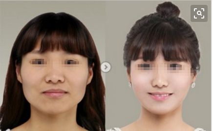 金華重瞼術(shù)醫(yī)院排行榜揭曉！前十強(qiáng)震撼上榜，你知道嗎？