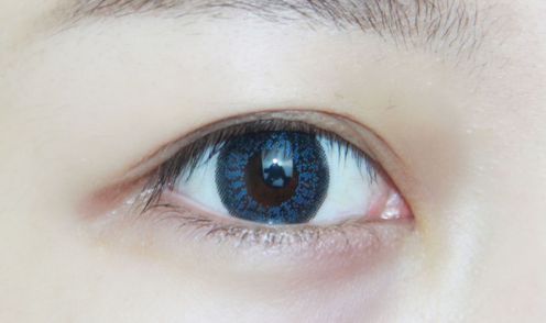 韓國眼球矯正術(shù)安全性解析與價格淺析，金魚眼矯正費用了解一下？