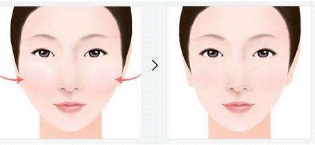 開封去眼袋醫(yī)院排行榜前十公開，揭秘超人氣整形機構(gòu)