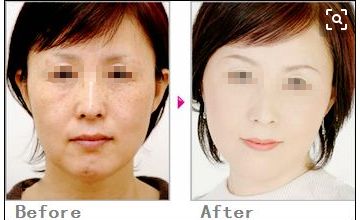 沈陽眼底紋微整形醫(yī)院排名前10，你需要知道的眼部美容信息