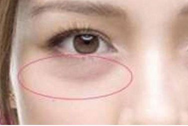 冰點(diǎn)脫毛效果實(shí)拍對比，輕松判斷是否值得嘗試