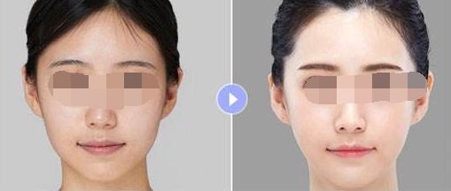 廣深整形醫(yī)院實(shí)力大PK：十強(qiáng)榜單大測(cè)評(píng)！