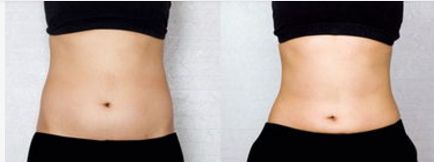 湖州專業(yè)美眼術(shù)醫(yī)院排名TOP10