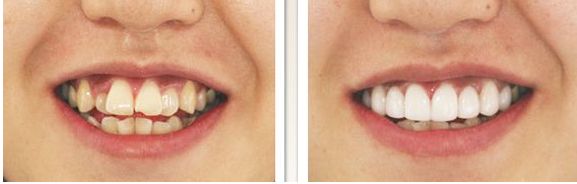 衡陽市鼻部整形口碑排行榜：曼特波隆鼻醫(yī)院專業(yè)排名前十