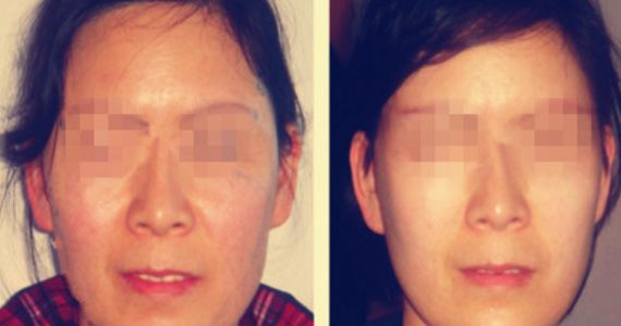 泰州修復鼻子醫(yī)院口碑排名揭秘，十大全新陣容揭曉！