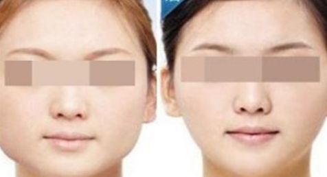 寧德E光嫩膚美容口碑前十整形醫(yī)院排行榜