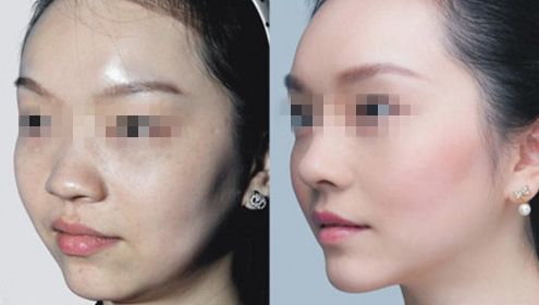 西寧隆胸醫(yī)院排名榜單揭秘！Top10暖心推薦，助您膨體自信重生！