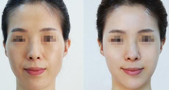 不同發(fā)質(zhì)者的專業(yè)洗發(fā)技巧，脫發(fā)問題終結(jié)攻略