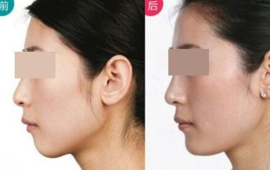 安全有效的脫發(fā)治療方法，告別禿頂困擾，重獲豐盈頭發(fā)！