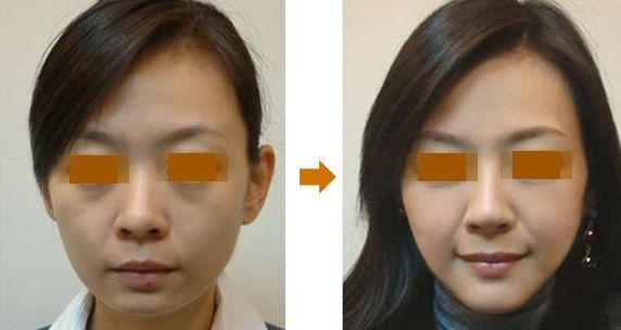 重慶豐臀術整形醫(yī)院實力大盤點：前10家推薦