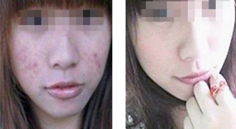 徐州十佳法令紋線雕整形醫(yī)院推薦