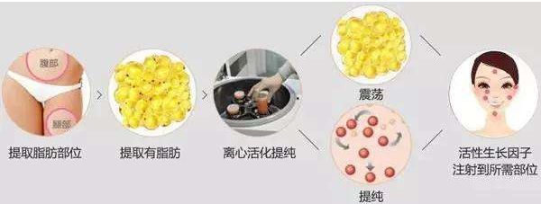 廣州膠原蛋白打臥蠶整形醫(yī)院排名揭秘！