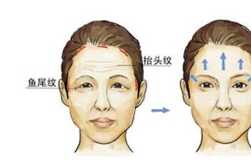 呼和浩特眼瞼去脂肪醫(yī)院排行榜：精選TOP10名單出爐！