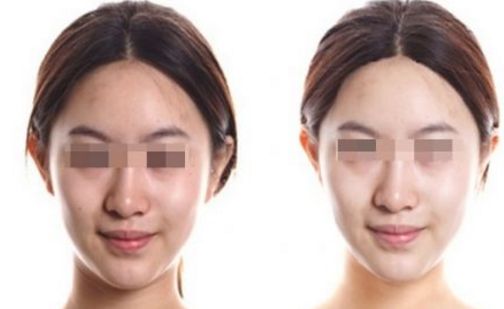 深圳微整形除疤醫(yī)院口碑排行榜