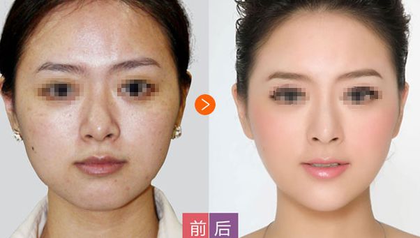 北京哪家整形醫(yī)院能有效改善皮膚皺紋？評測匯總揭曉