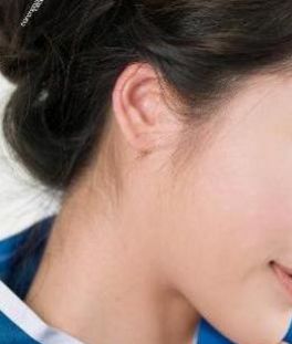 黃石治療假性眼袋吸脂排行榜TOP10！用戶好評(píng)如潮