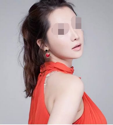 北京王明利脂肪填充面部收費(fèi)解析及用戶評價(jià)，驚喜價(jià)格引爆市場！