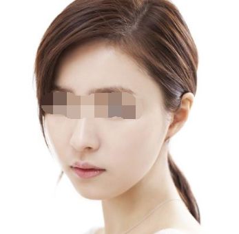 揭秘德州去除太田痣十大權(quán)威醫(yī)美機(jī)構(gòu)，必讀指南助您祛痣無憂