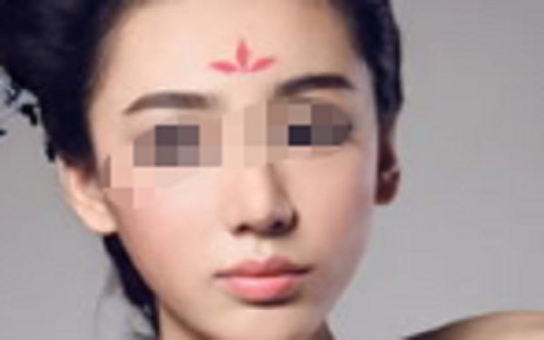 昆明眼周填充整形美容醫(yī)院口碑榜單：煥新眼眸魅力