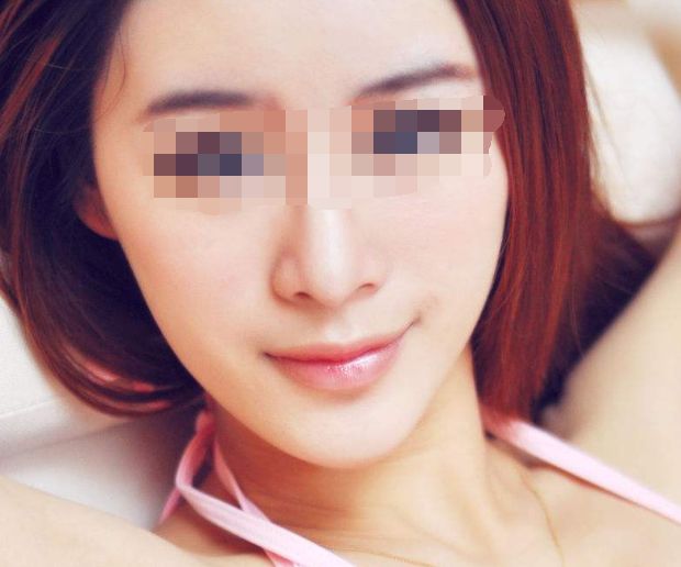 上海權(quán)威額頭紋去除醫(yī)院排行榜，免費咨詢！