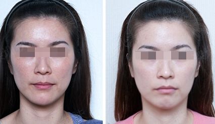 浙江十家專業(yè)治療黑痣的激光醫(yī)院排名及評(píng)測(cè)