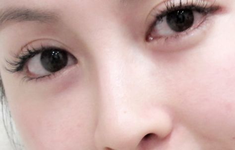 2024年鄭州光子嫩膚祛黑頭醫(yī)院口碑排行榜TOP10揭秘！