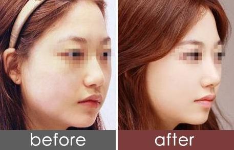 長(zhǎng)沙自體脂肪豐耳醫(yī)院口碑排行榜：揭秘10家專(zhuān)業(yè)機(jī)構(gòu)